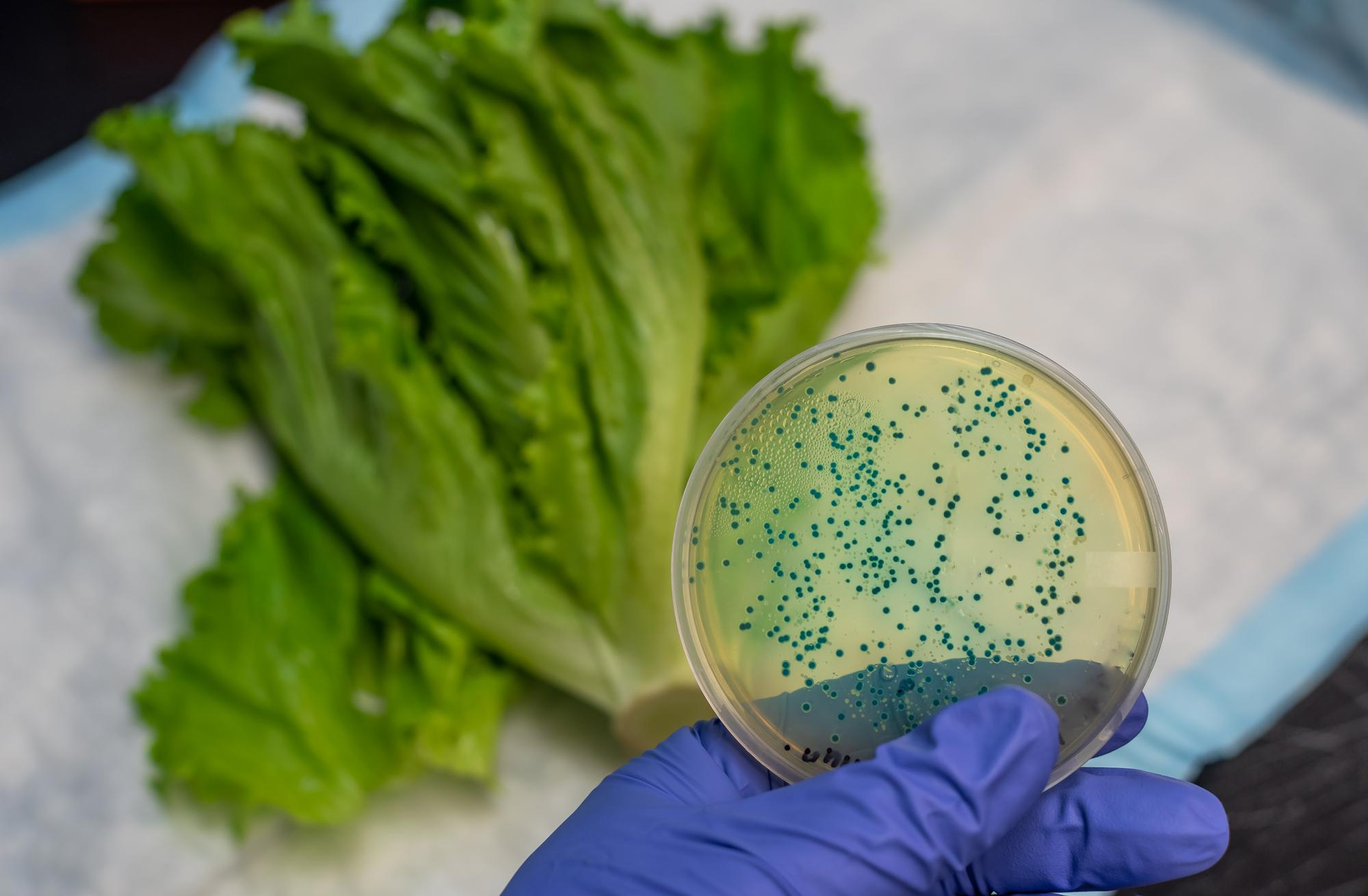 Lab Kinx Testing Microbiology Testing - LAB KinX